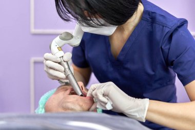 Doktor, güzellik tedavisi için hastaların ağzına lazer cihazı yerleştiriyor.