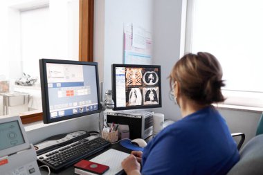 Kadın doktor hastanedeki tomografiden alınan görüntüleri inceliyor.