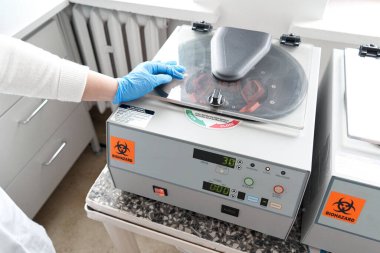 Top and close up view of a doctor using the reaction vessel of a centrifuge in a hospital