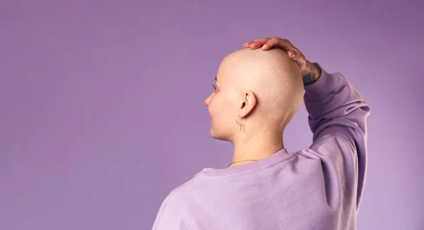 암으로 고통을 여자는 웃으면서 긍정적으로 머리를 천년기 — 스톡 사진