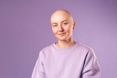 Kanserden muzdarip genç kadın gülüşü gelecekteki iyileşme hakkında olumlu düşünüyor. Milenyum dişisi, kafası kazınmış.