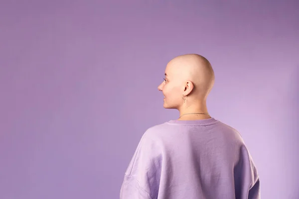 암으로 고통을 여자는 웃으면서 긍정적으로 머리를 천년기 — 스톡 사진
