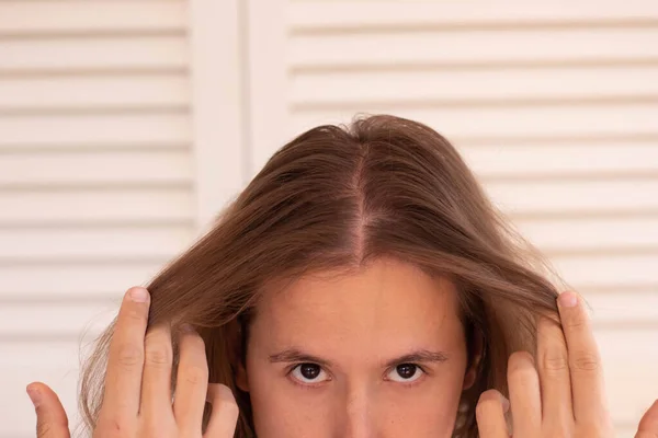 Close up view of young man with long hair showing his hair line with poor hair quantity for hair loss problems in white background