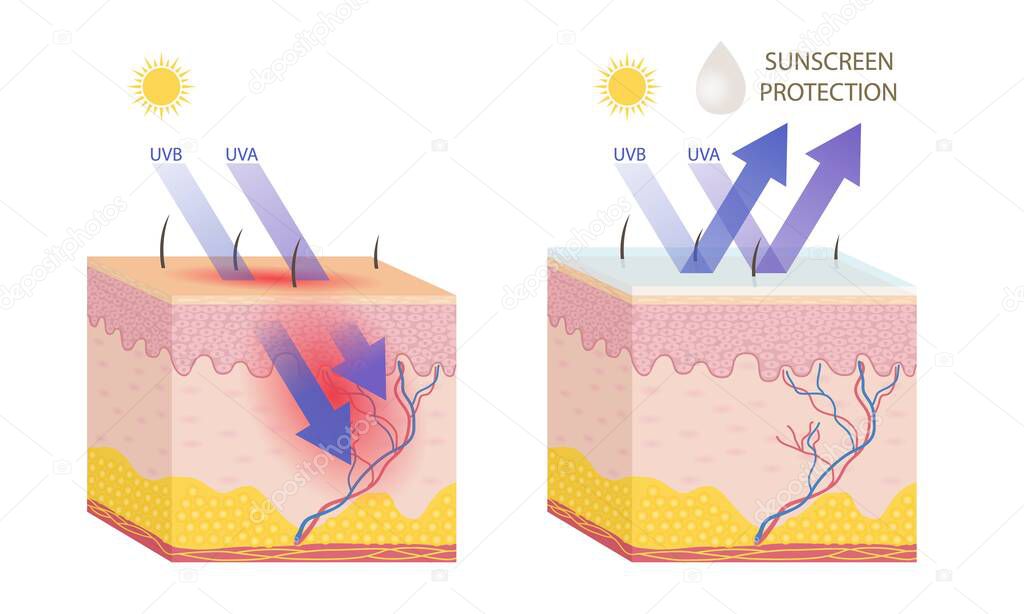 Human skin with and without sunscreen protection on white background.