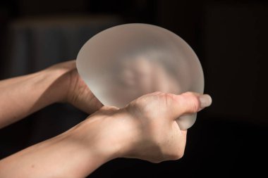 Kalitesini gösterirken kadın göğsünün silikon implantı..