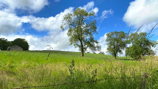 Αγροτικό Τοπίο Επικλινή Χωράφια Παλιά Δέντρα Και Σπασμένα Σύννεφα Kirby — Φωτογραφία Αρχείου