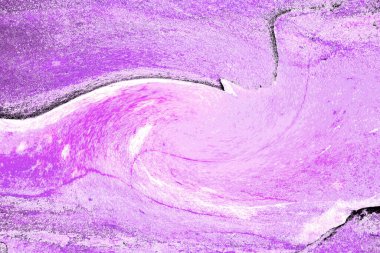 Köhne taş, aşınmış doku veya web tasarımı ve soyut arkaplan için grunge taş dokusu