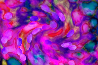 Soyut ışık. Bokeh arkaplan, vektör çizimi. Mistik mor. Büyülü renkler. Neşe.