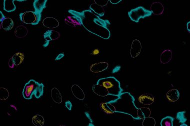 Soyut ışık. Bokeh arkaplan, vektör çizimi. Mistik mor. Büyülü renkler. Neşe.