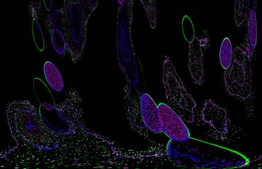Neon parıltısı arka planı. Akan doku. Odaklanamayan kıvılcımlar. Bokeh parıltısı. Floresan moru. Mavi. Magenta. Pembe. Gradyan ışık. Parlak röfleler. Desen.