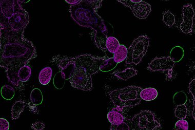 Neon parıltısı arka planı. Akan doku. Odaklanamayan kıvılcımlar. Bokeh parıltısı. Floresan moru. Mavi. Magenta. Pembe. Gradyan ışık. Parlak röfleler. Desen.