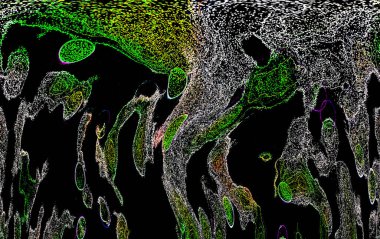 Neon parıltısı arka planı. Akan doku. Odaklanamayan kıvılcımlar. Bokeh parıltısı. Floresan moru. Mavi. Magenta. Pembe. Gradyan ışık. Parlak röfleler. Desen.