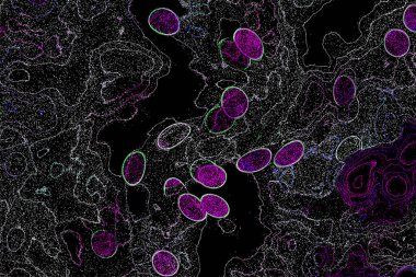 Neon parıltısı arka planı. Akan doku. Odaklanamayan kıvılcımlar. Bokeh parıltısı. Floresan moru. Mavi. Magenta. Pembe. Gradyan ışık. Parlak röfleler. Desen.