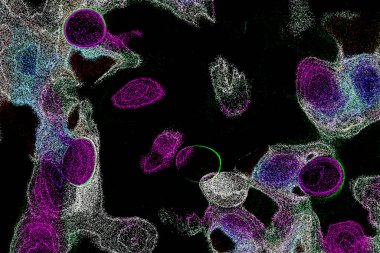 Neon parıltısı arka planı. Akan doku. Odaklanamayan kıvılcımlar. Bokeh parıltısı. Floresan moru. Mavi. Magenta. Pembe. Gradyan ışık. Parlak röfleler. Desen.