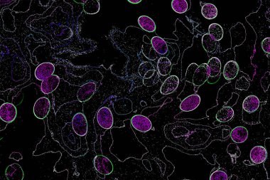 Neon parıltısı arka planı. Akan doku. Odaklanamayan kıvılcımlar. Bokeh parıltısı. Floresan moru. Mavi. Magenta. Pembe. Gradyan ışık. Parlak röfleler. Desen.