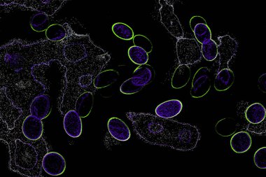 Neon parıltısı arka planı. Akan doku. Odaklanamayan kıvılcımlar. Bokeh parıltısı. Floresan moru. Mavi. Magenta. Pembe. Gradyan ışık. Parlak röfleler. Desen.