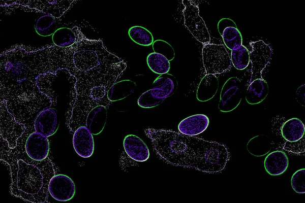 Neon parıltısı arka planı. Akan doku. Odaklanamayan kıvılcımlar. Bokeh parıltısı. Floresan moru. Mavi. Magenta. Pembe. Gradyan ışık. Parlak röfleler. Desen.