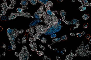 Neon parıltısı arka planı. Akan doku. Odaklanamayan kıvılcımlar. Bokeh parıltısı. Floresan moru. Mavi. Magenta. Pembe. Gradyan ışık. Parlak röfleler. Desen.