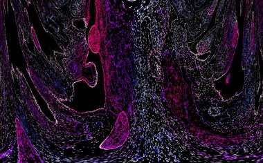 Neon parıltısı arka planı. Akan doku. Odaklanamayan kıvılcımlar. Bokeh parıltısı. Floresan moru. Mavi. Magenta. Pembe. Gradyan ışık. Parlak röfleler. Desen.