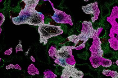 Neon parıltısı arka planı. Akan doku. Odaklanamayan kıvılcımlar. Bokeh parıltısı. Floresan moru. Mavi. Magenta. Pembe. Gradyan ışık. Parlak röfleler. Desen.