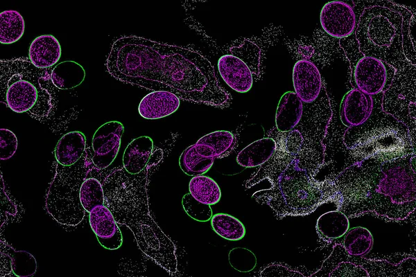 Neon parıltısı arka planı. Akan doku. Odaklanamayan kıvılcımlar. Bokeh parıltısı. Floresan moru. Mavi. Magenta. Pembe. Gradyan ışık. Parlak röfleler. Desen.