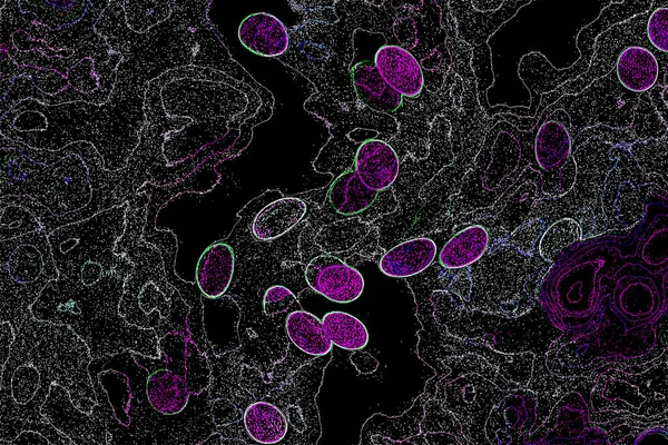 Neon parıltısı arka planı. Akan doku. Odaklanamayan kıvılcımlar. Bokeh parıltısı. Floresan moru. Mavi. Magenta. Pembe. Gradyan ışık. Parlak röfleler. Desen.