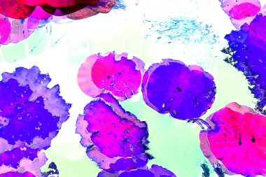 Nilüfer yaprakları ve nilüfer yapraklarıyla sunulan zarif desenli tasarım.