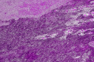 Kırsal taşlar, paslanmış dokular, renkli ve ilginç arka planlar ve büyüleyici dokular, web tasarımı ve soyut arkaplanlar için kullanılır.