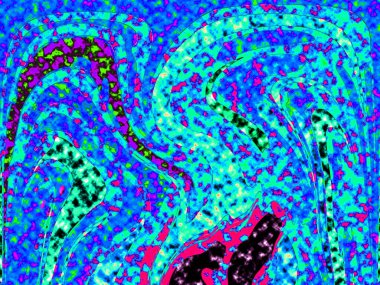 Dalgalı çizgiler. Soyut çizgiler. Doku arka planı. düzensiz desen. Şık modern. Pop sanat. Nokta etkisi. Ritmik gürültü parçacıkları. Paket için desen. Renkli vuruşlu duvar kağıdı.