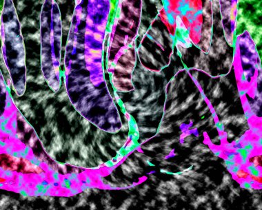 Modern tasarım çizimi. Çizgi ve renk bloğu geometrik şekiller. Pop sanat