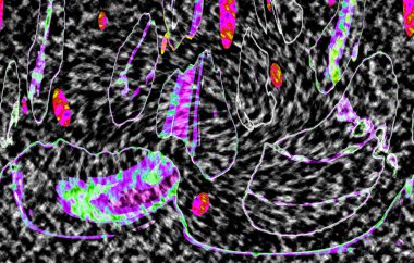 Modern tasarım çizimi. Çizgi ve renk bloğu geometrik şekiller. Pop sanat