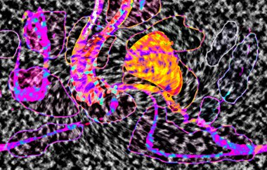Modern tasarım çizimi. Çizgi ve renk bloğu geometrik şekiller. Pop sanat