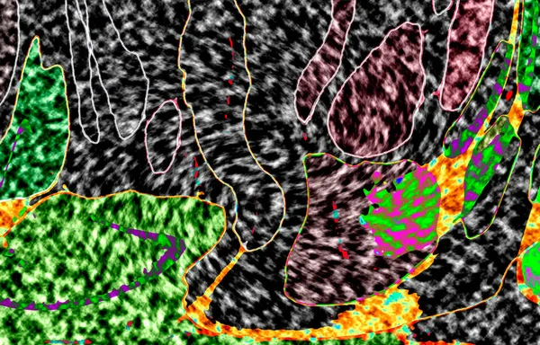 Modern tasarım çizimi. Çizgi ve renk bloğu geometrik şekiller. Pop sanat