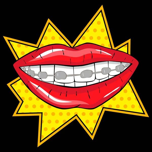 Vector Illustration Red Lip Braces Teeth Comics Style — Stok Vektör
