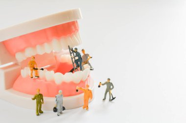 Minyatür insanlar, küçük model insan figürü. Fotokopi alanı olan temiz dişler. Tıbbi ve diş konsepti. Diş bakımında takım çalışması.