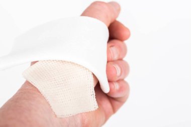 Bilek derisinde hidroksit sodyum asitle kimyasal yanıklar var. İltihaplı ve derin yara. Ev kazası, mavi eldivenlerin keskin olması yüzünden. Steril parafin gazlı bez pansuman yap ve üzerine bastır. Seçici odak