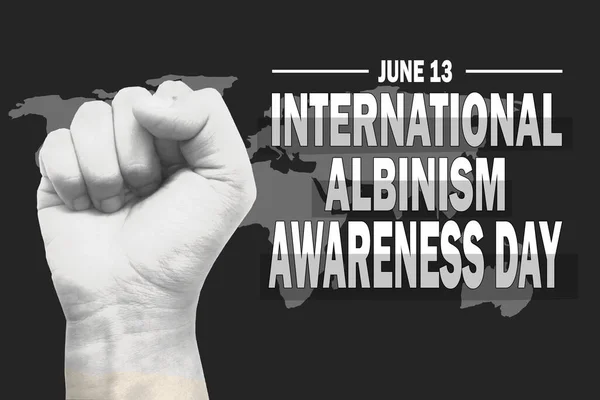 Международный День Осведомленности Альбинизме Празднования Международного Дня Альбинизма Плоский Дизайн — стоковое фото