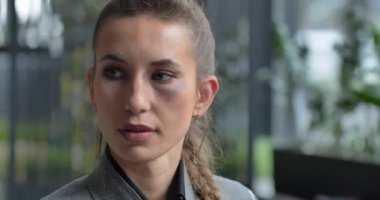 Utangaç kadın gözünün altındaki morluğu kapatıyor. Aile içi şiddet.