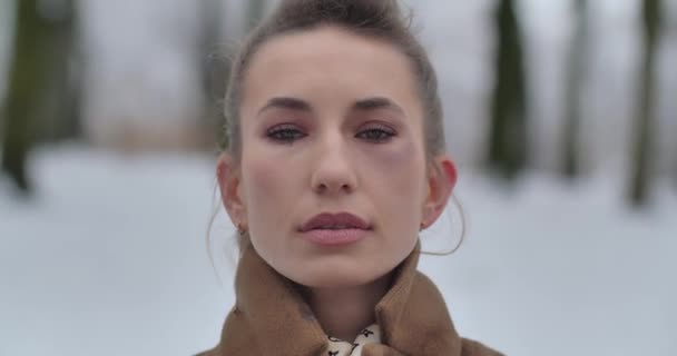 A young girl stands alone on the street and cries, and a bruise under the eye. — Stock Video