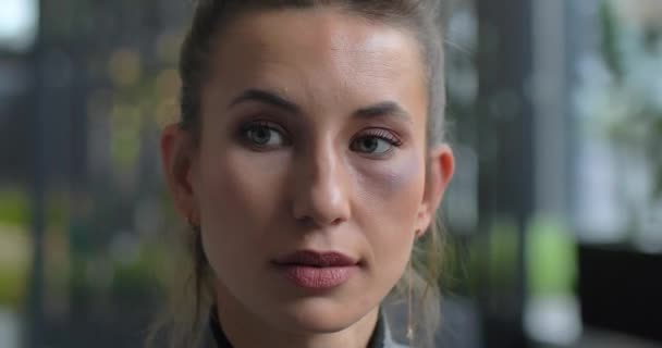 Verwirrte Frau deckt eine Prellung mit der Hand ab. Er litt unter häuslicher Gewalt — Stockvideo