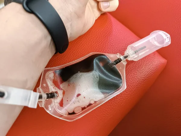 Donación Sangre Transfusión Sangre Control Especificado Ayuno Atención Médica Brazo — Foto de Stock