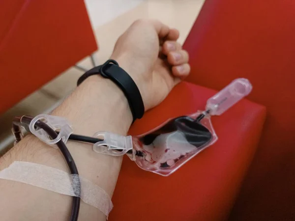 特定のチェック 健康管理 寄付センターで血液や血漿の寄付のための機器を持つ白人青年の腕を残しました 献血の概念 プラズマ寄付の概念 命の概念を救う — ストック写真
