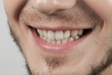 diş hekimliği, dişler, gülümseme, ilaç