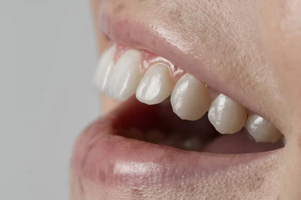 diş hekimliği, dişler, gülümseme, ilaç