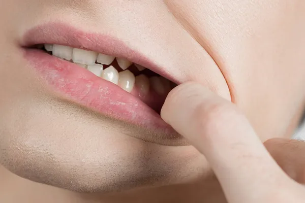 diş hekimliği, dişler, gülümseme, ilaç