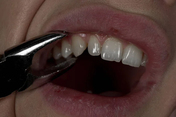 diş hekimliği, dişler, gülümseme, ilaç