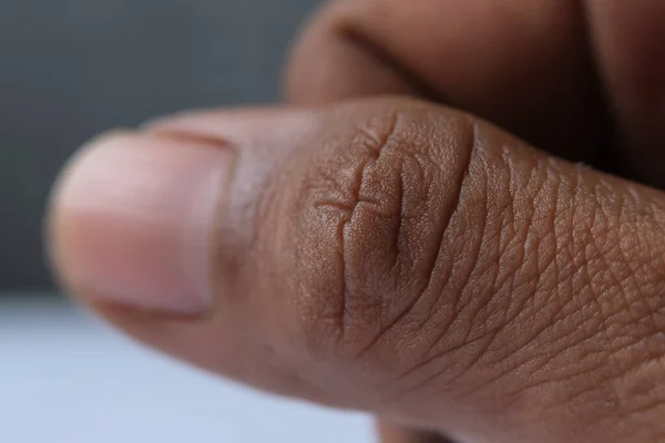 Human skin texture on thumb