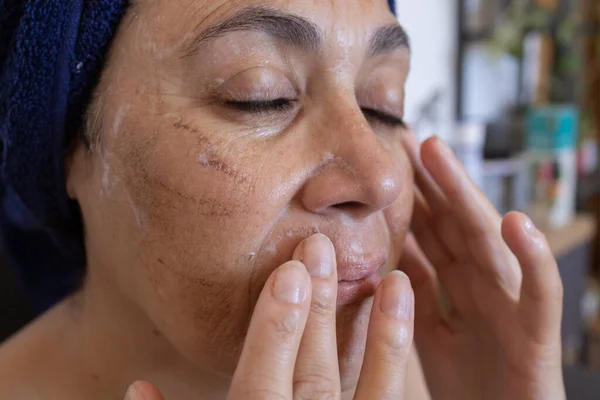 deep Chemical peelings for face treatment with acid to remove skin blemishes