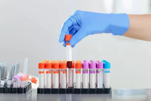 Zařízení pro odběr krve v laboratoři pro analýzu — Stock fotografie