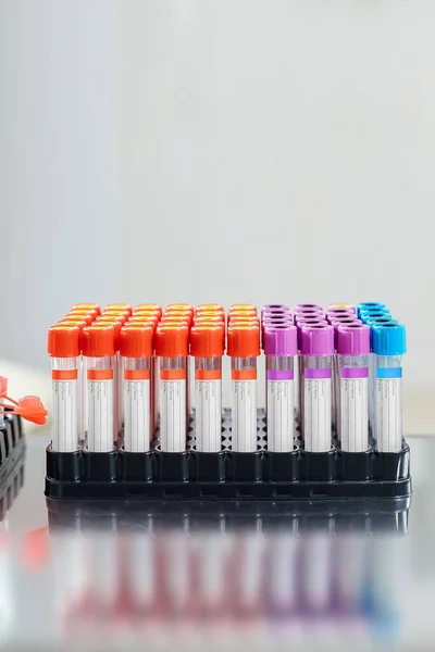 Equipamento de coleta de sangue em laboratório para análise — Fotografia de Stock